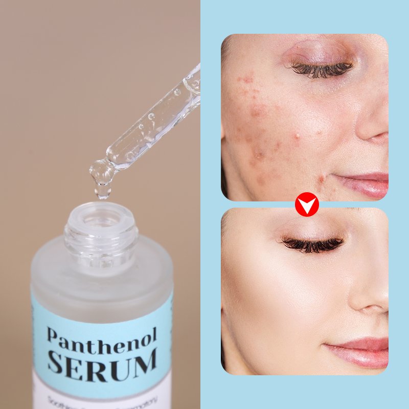 Skincare Ordinary Niacinamide Serum - 13